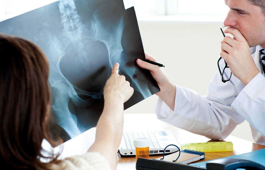 лікарі вивчають рентгенівський знімок при кульшовому артрозі